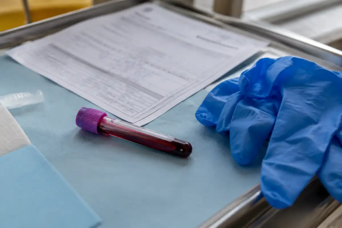 Tube de prélèvement sanguin et formulaire de laboratoire sur un plateau